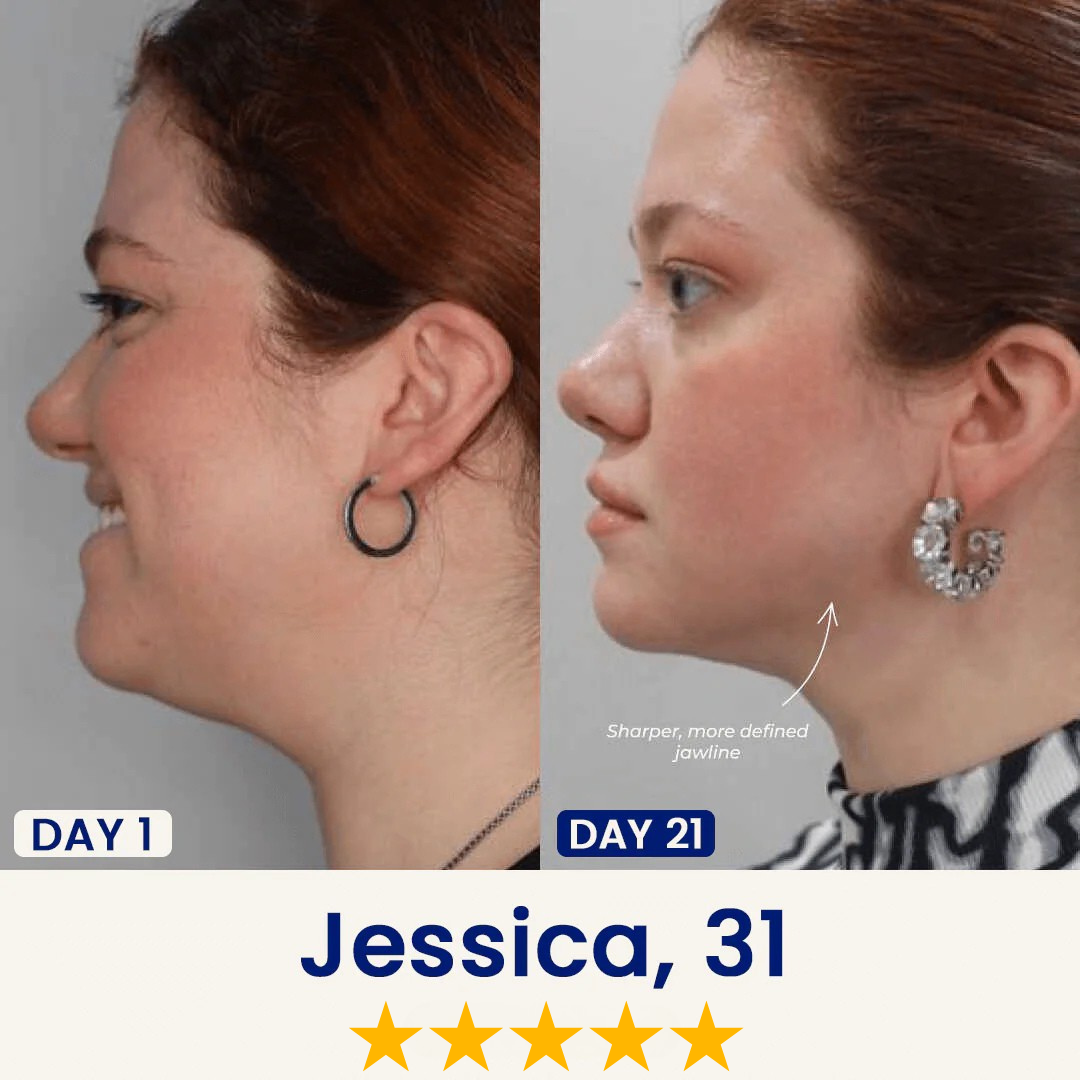 Liftology - Say Goodbye to Your Double Chin Now