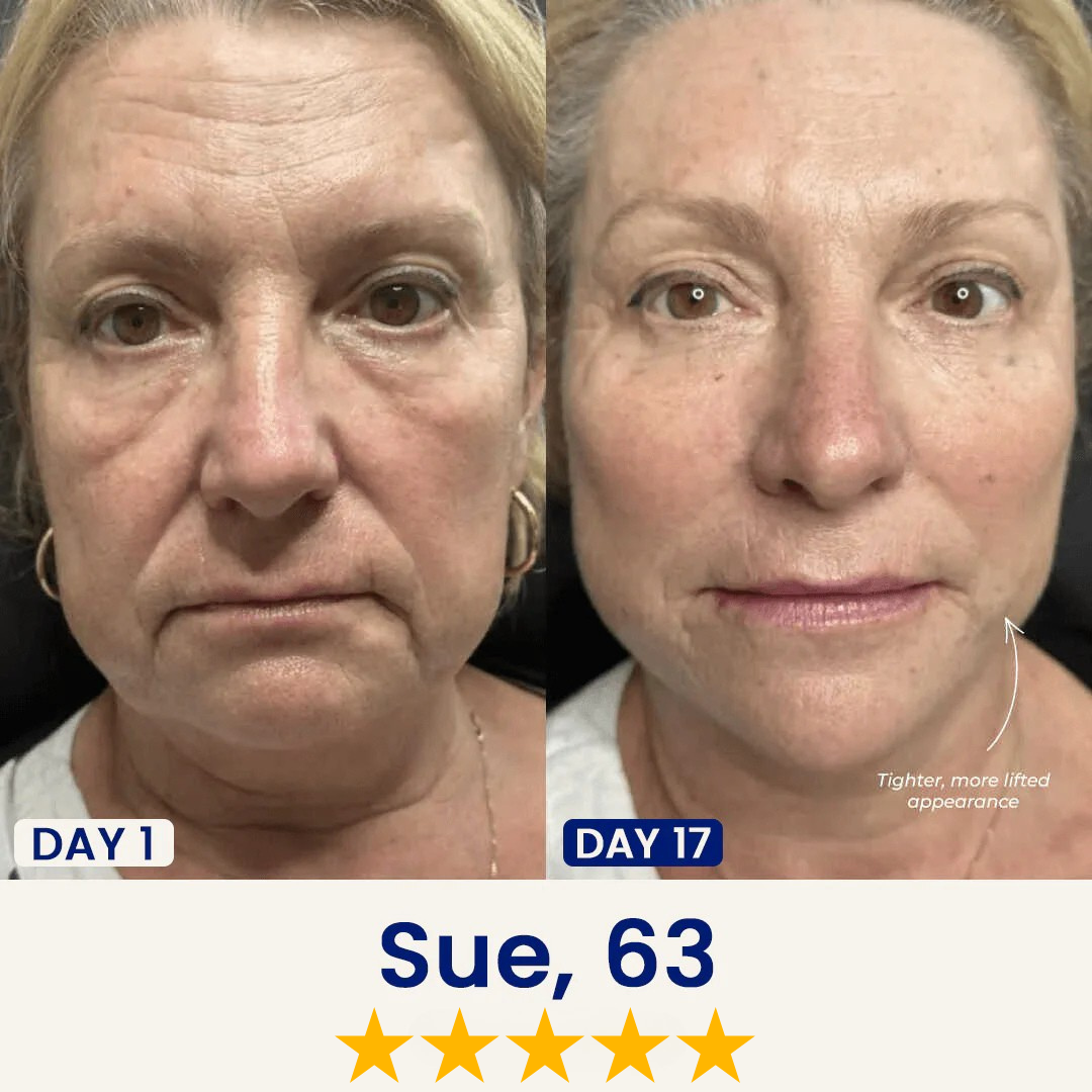 Liftology - Say Goodbye to Your Double Chin Now