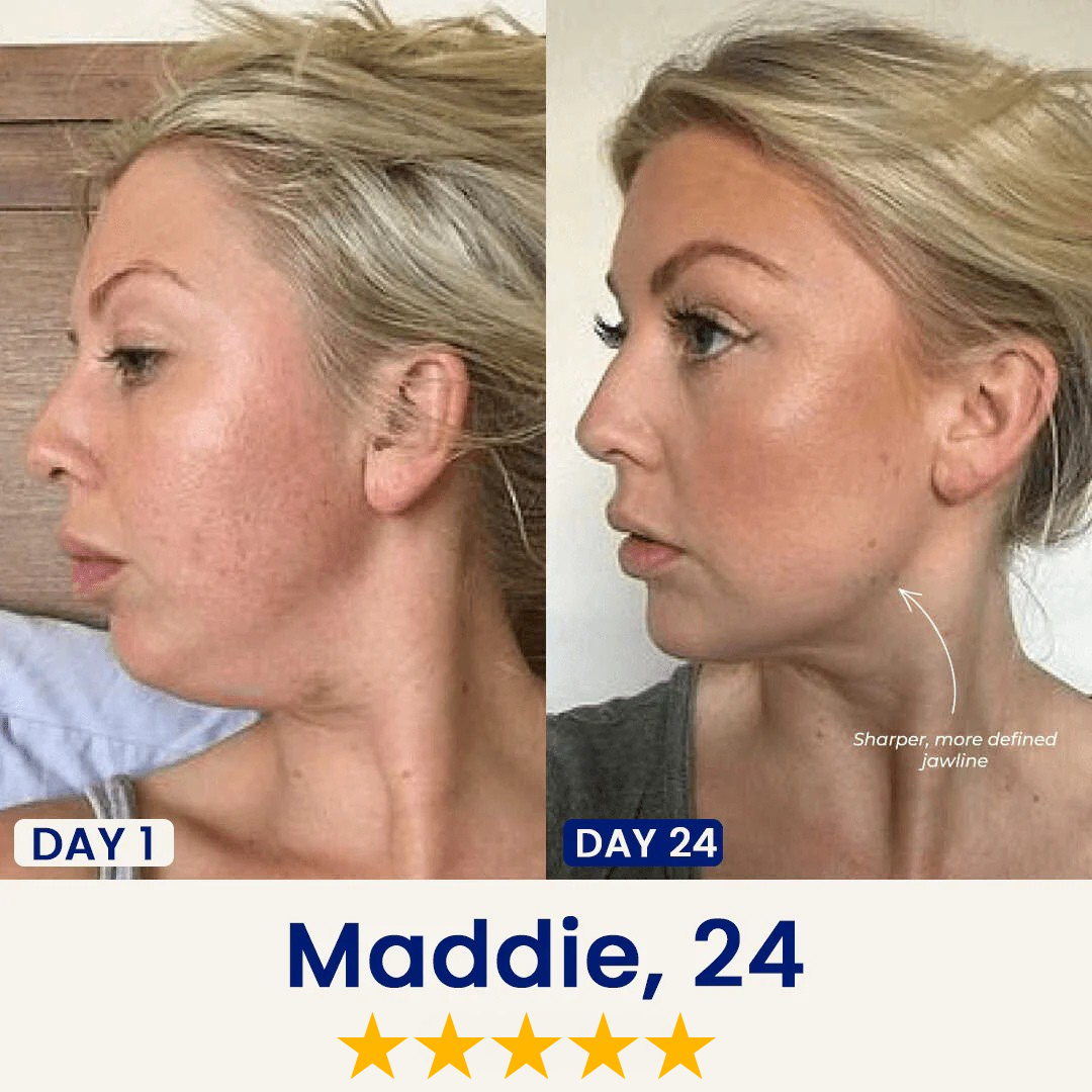 Liftology - Say Goodbye to Your Double Chin Now